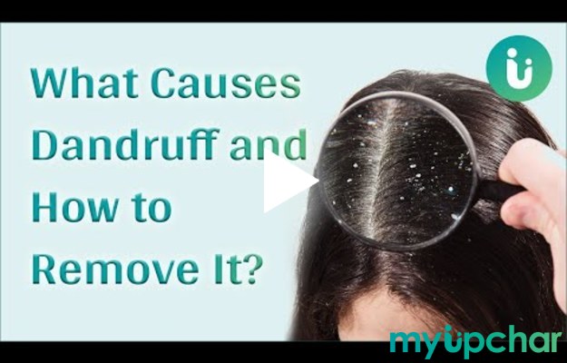 What actually causes Dandruff and how can you get rid of it?