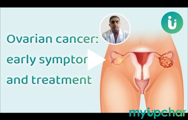 World Cancer Day 2022: all you need to know about Ovarian Cancer