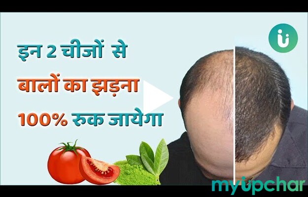 myUpchar