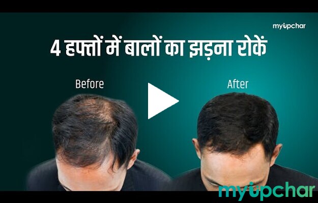 A Powerful Remedy to Stop Hair Fall and Baldness – Even R...